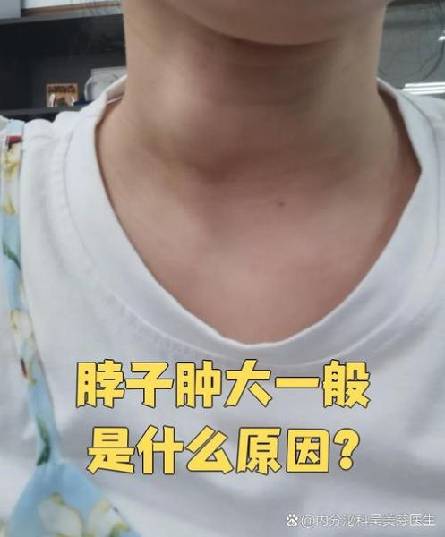 脖子为什么叫脖子_脖子有哪些比喻说法