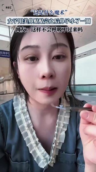 鼻子小怎么办_鼻子小会影响呼吸吗