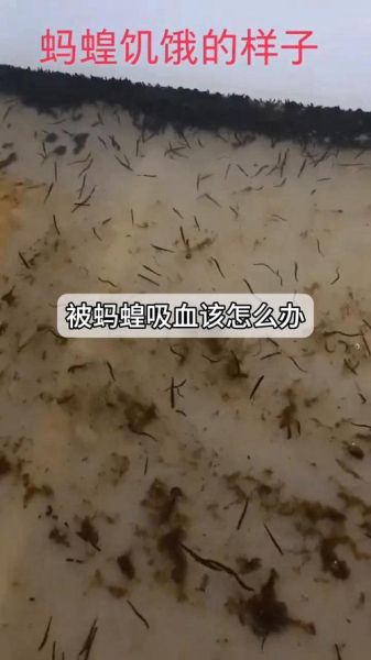 梦到蚂蝗吸在身上_是什么意思