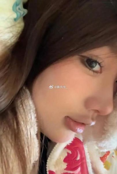 隆鼻会带来财运吗_隆鼻后真的招财吗