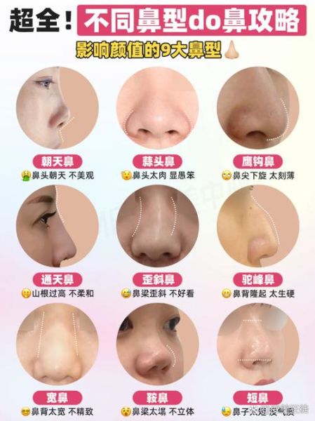 隆鼻后会改变运势吗_隆鼻对运势的影响