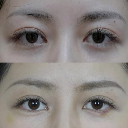 卧蚕和运势有关吗_卧蚕影响财运吗