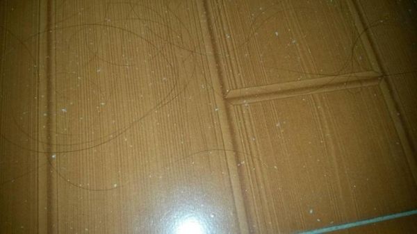 梦见头屑很多_梦见头屑是什么预兆