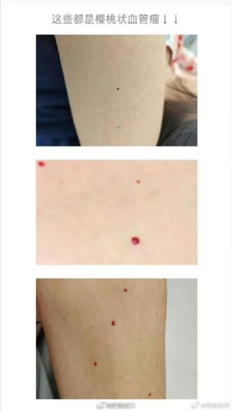 梦到红点是什么意思_梦到红点预示什么