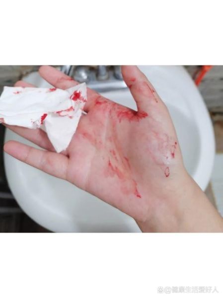 梦到手流血是什么征兆_梦见手流血预示什么