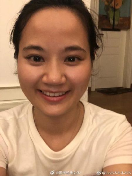 额头饱满财运好吗_额头窄会影响财运吗